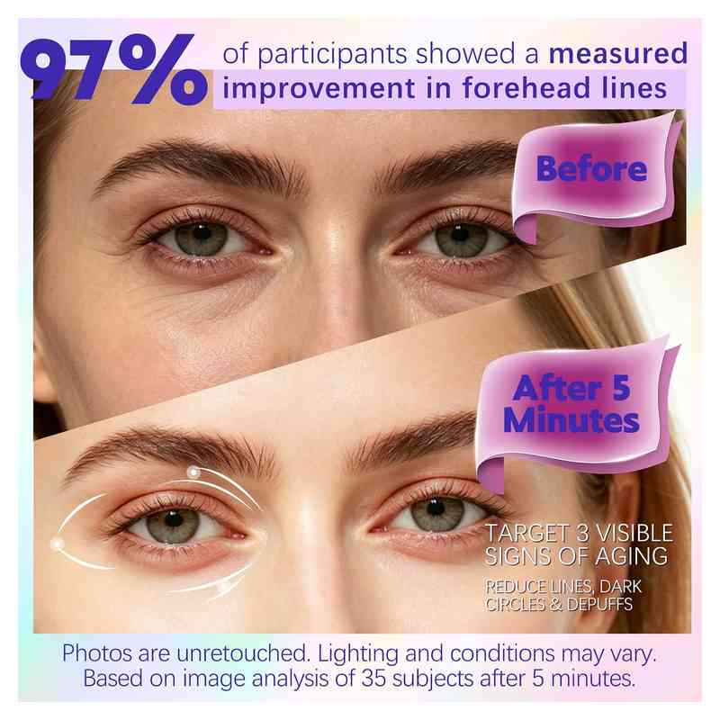 [BUY 1 GET 1 FREE] Instant Lift Eye Gel for Dark Circles & Puffiness