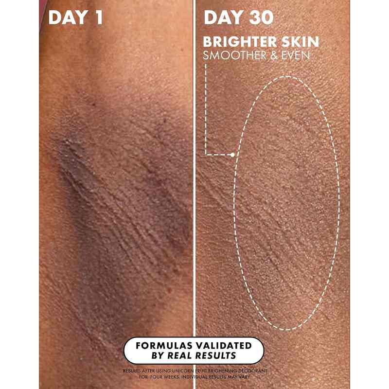 [🎁 BUY 1 GET 1 FREE] All-Natural Brightening Aluminum-Free Deodorant Stick
