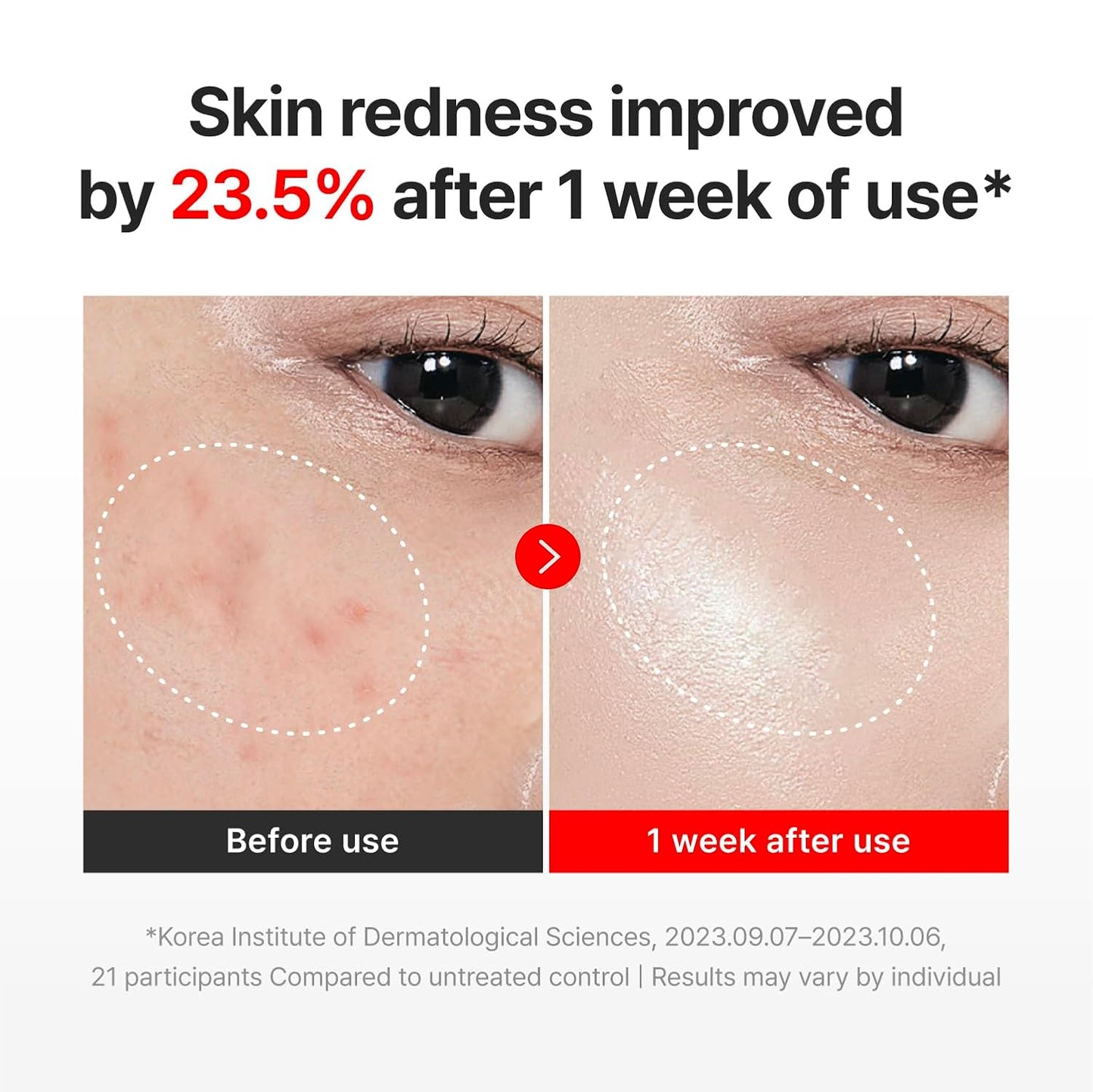Intensive TECA Cellular Elasticity & Time Reverse Cream