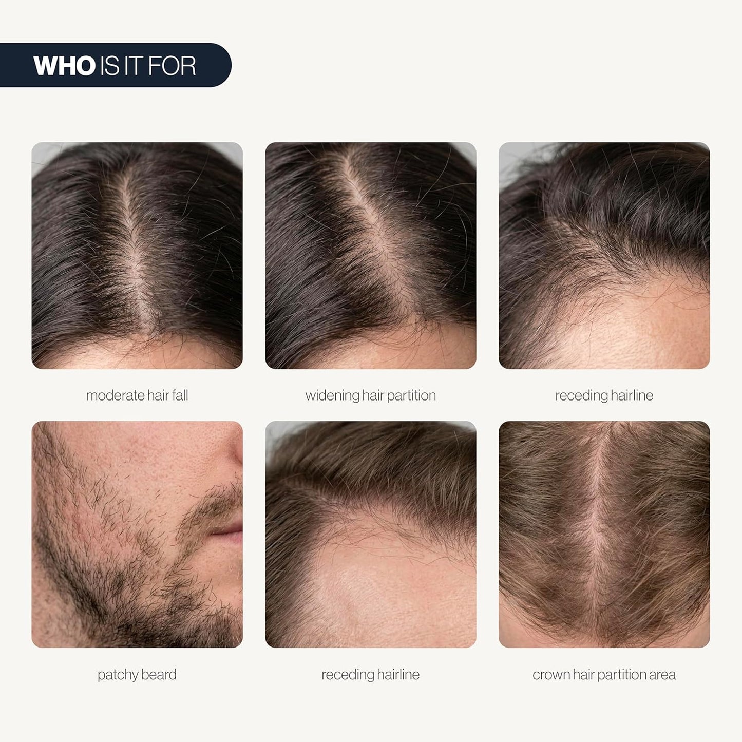 Advanced Hair Growth Roll-On Serum — Target Thicker Roots & Reactivate Follicles Directly