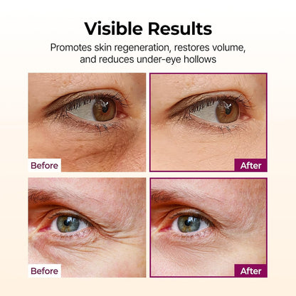 The 10-Second Eye-Lifting Balm That Erases Fine Lines On the Go