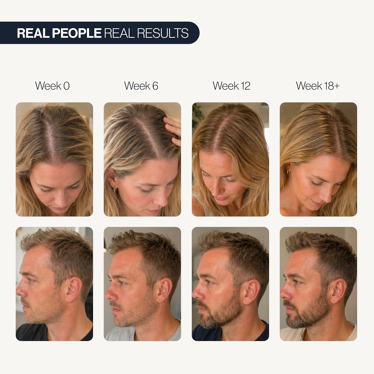 Advanced Hair Growth Roll-On Serum — Target Thicker Roots & Reactivate Follicles Directly