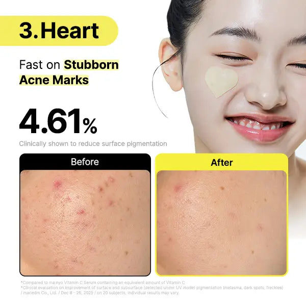 Targeted Glutathione & Niacinamide Hydrogel Patches for Visible Dark Spot & Hyperpigmentation Fading