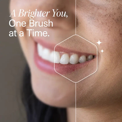[🎁 BUY 1 GET 1 FREE] Rebuild Enamel & Whiten Teeth Safely Without Fluoride