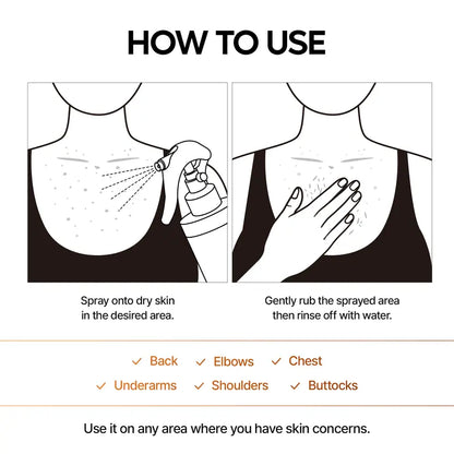 Smooth, Radiant Skin in Seconds: Instant Exfoliating Kojic Acid & Turmeric Body Spray