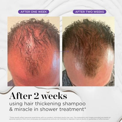Hair Thickening Serum Set – Prebiotic Scalp Revitalizing Treatment For Advanced Hair Thinning Control